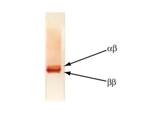 Anti-S100 antibody [4B3] used in Western Blot (WB). GTX14849